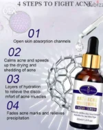 Aichun Beauty Anti Acne Whitening Facial Serum