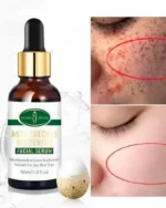 Aichun Beauty Anti Freckle Whitening Facial Serum