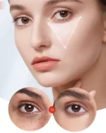 Kormesic Kojic Acid And Collagen Eye Cream - 20g - Image 2